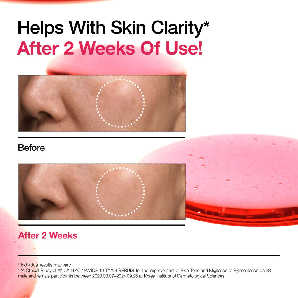 [ANUA] NIACINAMIDE 10 TXA 4 SERUM 30ml