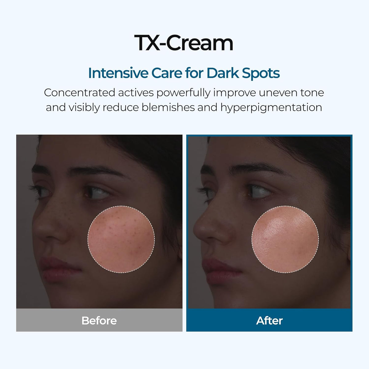 [Dr.Melaxin] Dr.Melaxin TX Cream 50ml
