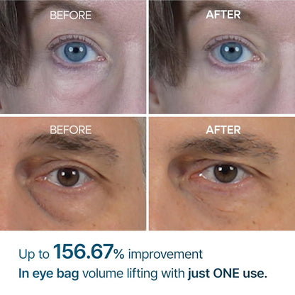 [Dr.Melaxin] Dr.Melaxin Eyephalt Eyecream for Eyebags 10ml