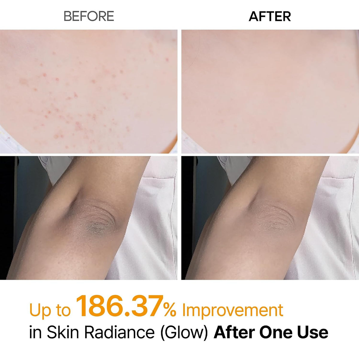 [Dr.Melaxin] Dr.Melaxin Peel Shot Exfoliating Kojic Acid Turmeric Spray 200ml