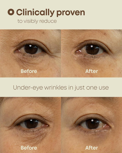 [NINELESS] Ever-Youth Dual Effect Eye Cream 20ml