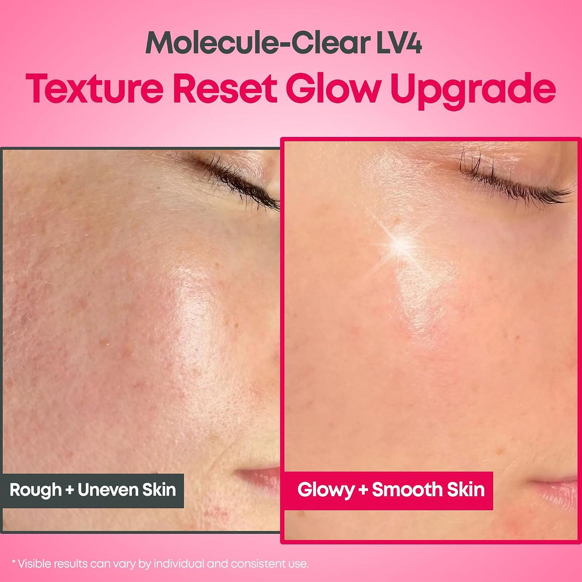 [NINELESS] Molecule-Clear 5% Glycolic Acid Serum 30ml