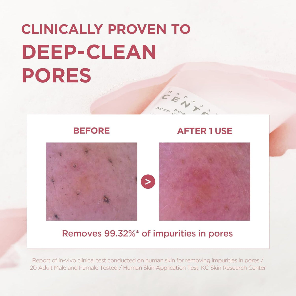 [SKIN1004] Poremizing Deep Cleansing Foam 125ml