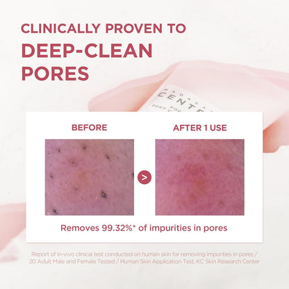 [SKIN1004] Poremizing Deep Cleansing Foam 125ml